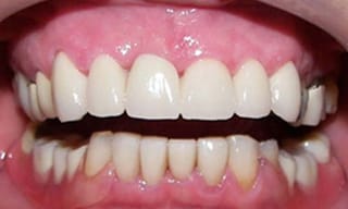 Before After Dental Case