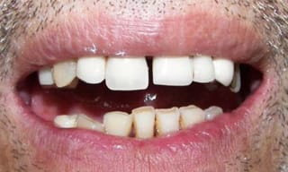 Before After Dental Case