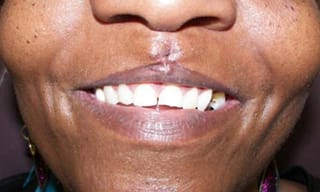 Before After Dental Case